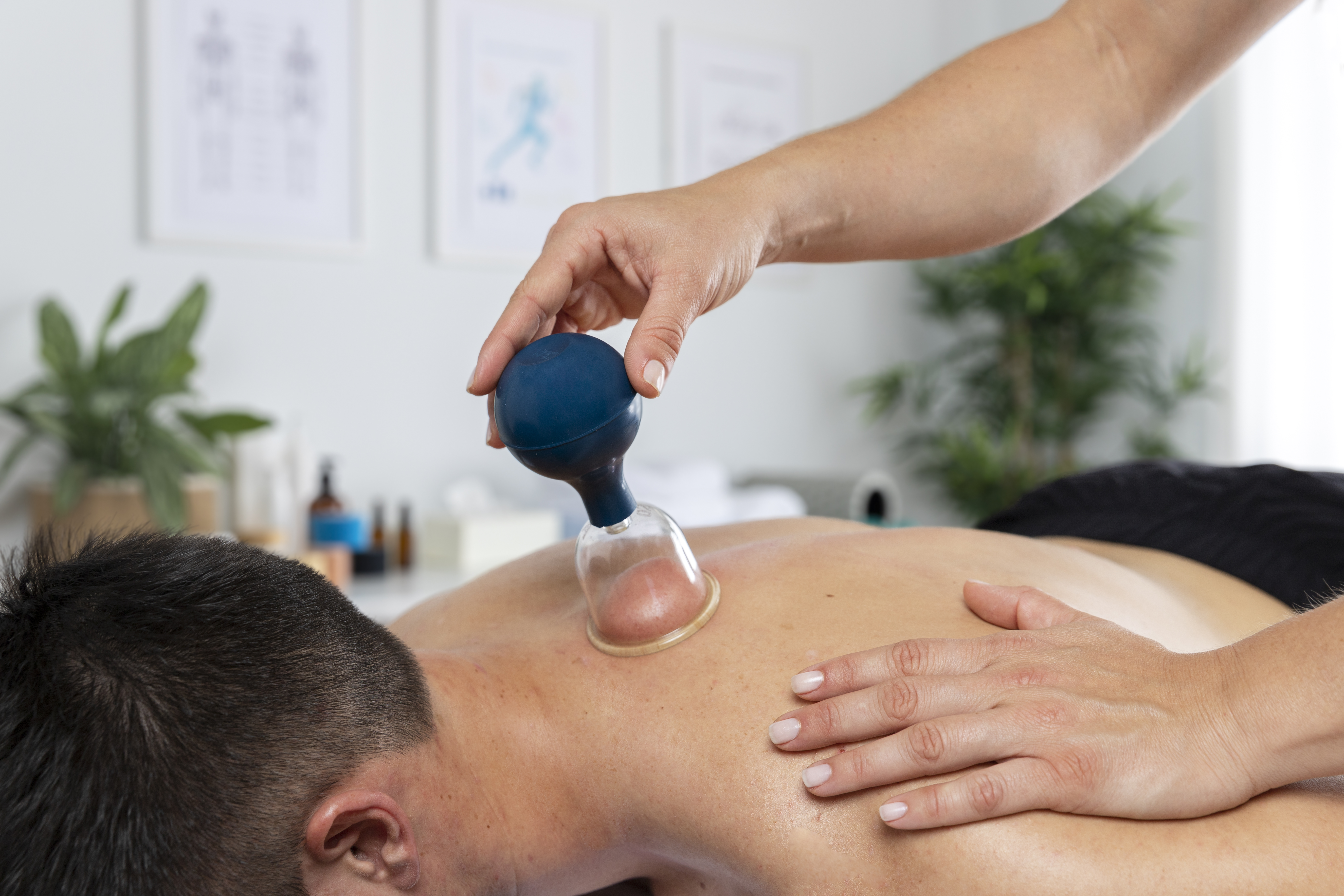 physiotherapist-performing-cupping-session-male-patient